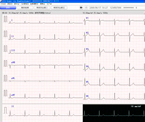 心電計ＥＣＧ−１２５０