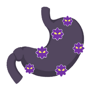 胃がんのイラスト画像